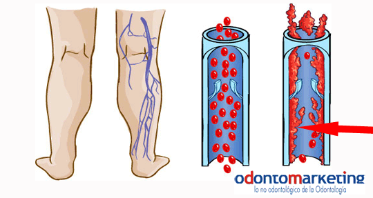 Ergonomía en Odontología www.odontomarketing.com