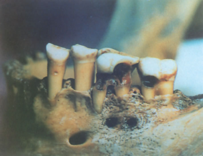 Odontomarketing Historia de la Odontología