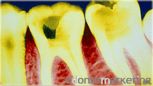 Noticias dentales Novedades y datos del mundo de la Odontología